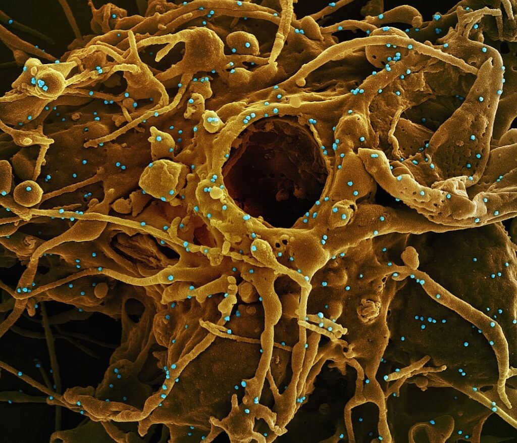 Neutrogena Recalls Makeup Wipes Over Bacterial Contamination Concerns