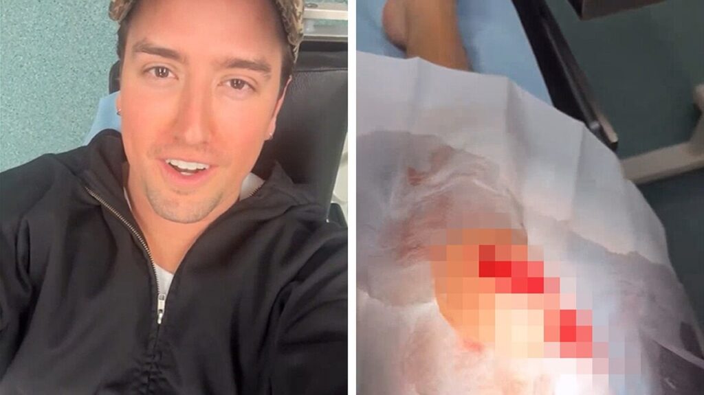 Big Time Rush’s Logan Rushed to Hospital After Slicing Open Knee Onstage, See Pic