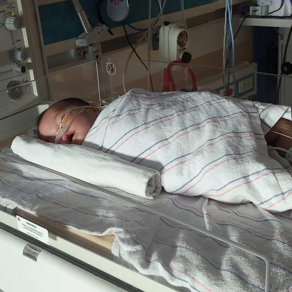 There’s a Botulism Outbreak. What Do You Need to Know?