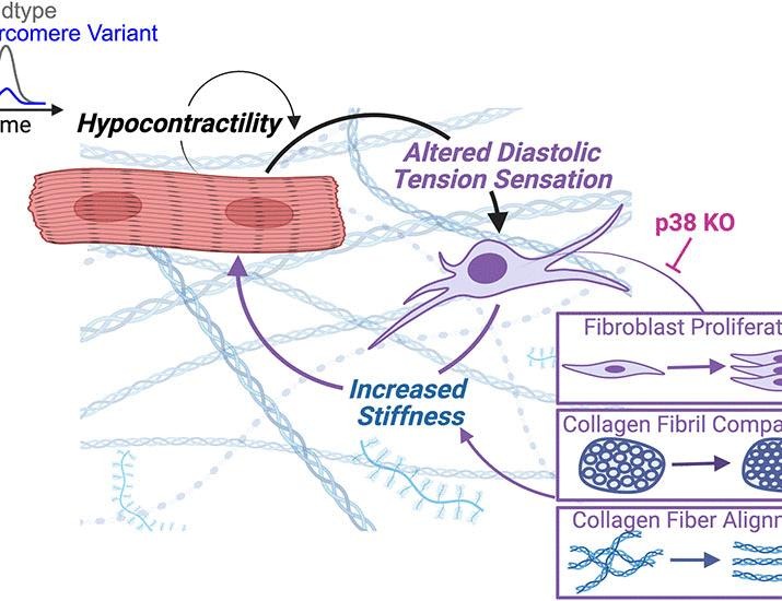Preventing hypocontractility-induced fibroblast expansion alleviates dilated cardiomyopathy | Science