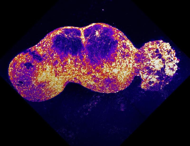 The need for a global effort to attend to human neural organoid and assembloid research | Science