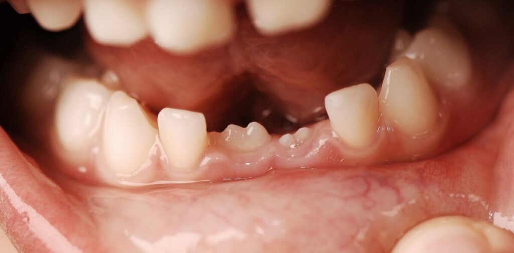 Why do people have baby teeth and adult teeth?