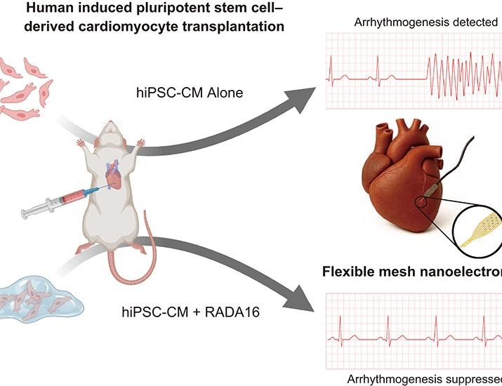 Flexible nanoelectronics reveal arrhythmogenesis in transplanted human cardiomyocytes | Science