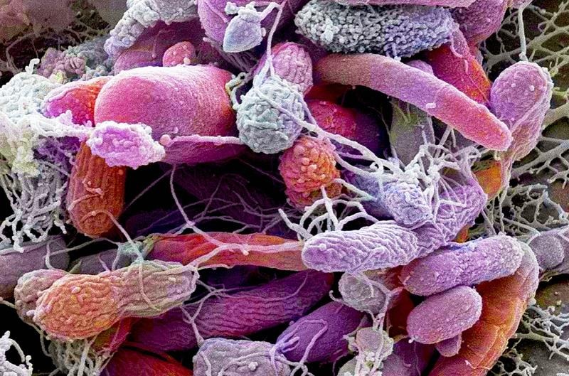 Research linking gut microbes to autism is deeply flawed, critics say