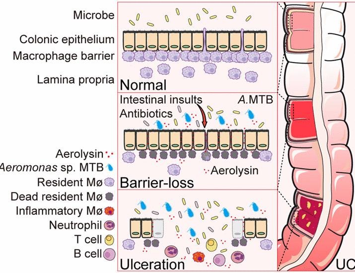 An Aeromonas variant that produces aerolysin promotes susceptibility to ulcerative colitis | Science