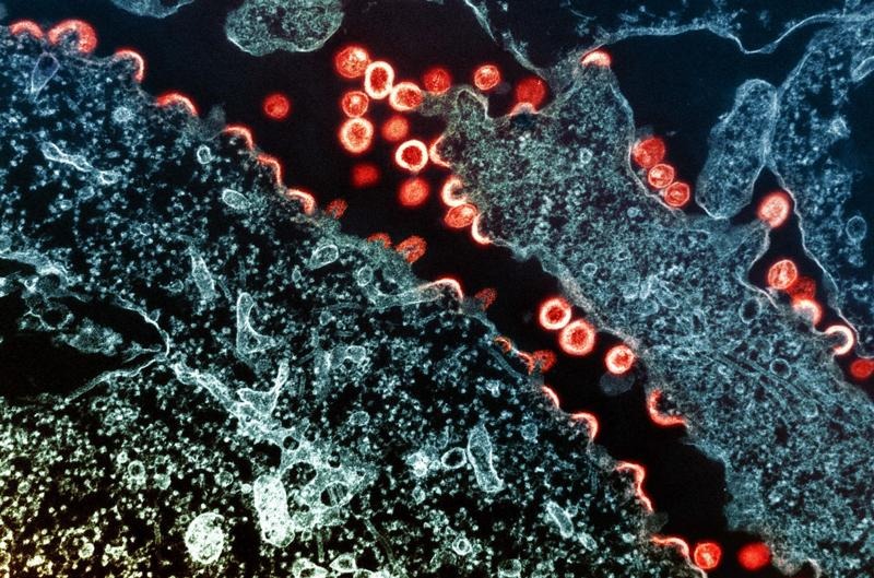 How some treatments can lead to a ‘functional cure’ for HIV