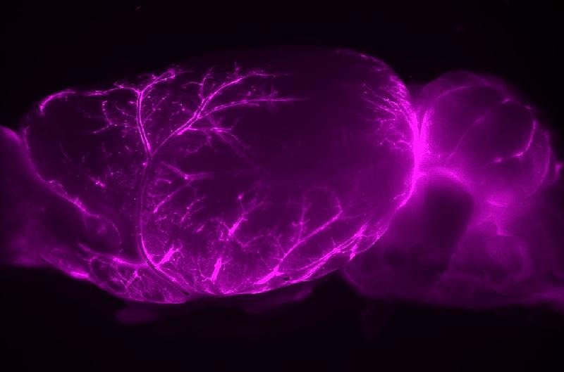 Brain’s ‘plumbing’ inspires new Alzheimer’s strategies—and controversial surgeries