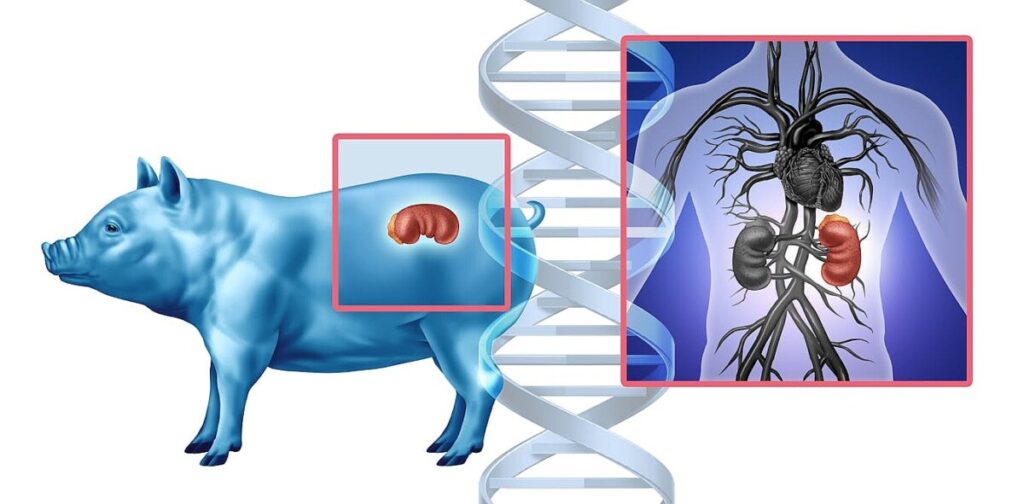 Putting pig organs in people is OK in the US, but growing human organs in pigs is not – why is that?
